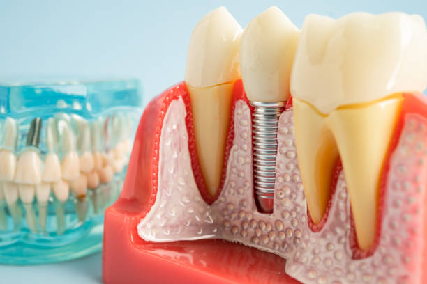 Best Periodontal (Gum) Disease Treatment  in River Edge, NJ